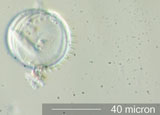 Diatom, Stephanodiscus